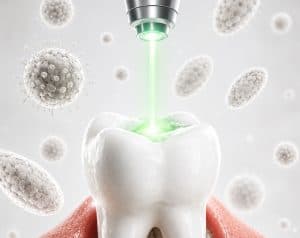 Regeneración Dental